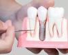 Dental Implants, Invisalign, Crowns, Dentures | Glastonbury, CT