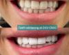 Get Your Brightest Smile with LED Teeth Whitening Treatment in Pascoe Vale